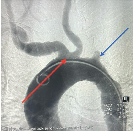 Casazza Figure 5a  July 2024