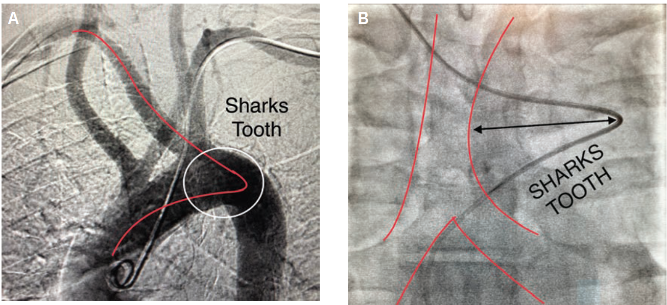 Casazza Figure 2 May 2024