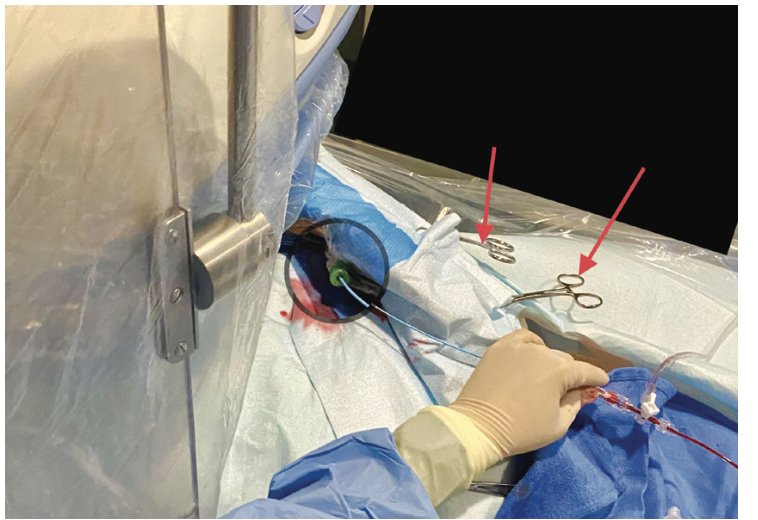 Casazza Left Ulnar Figure 2