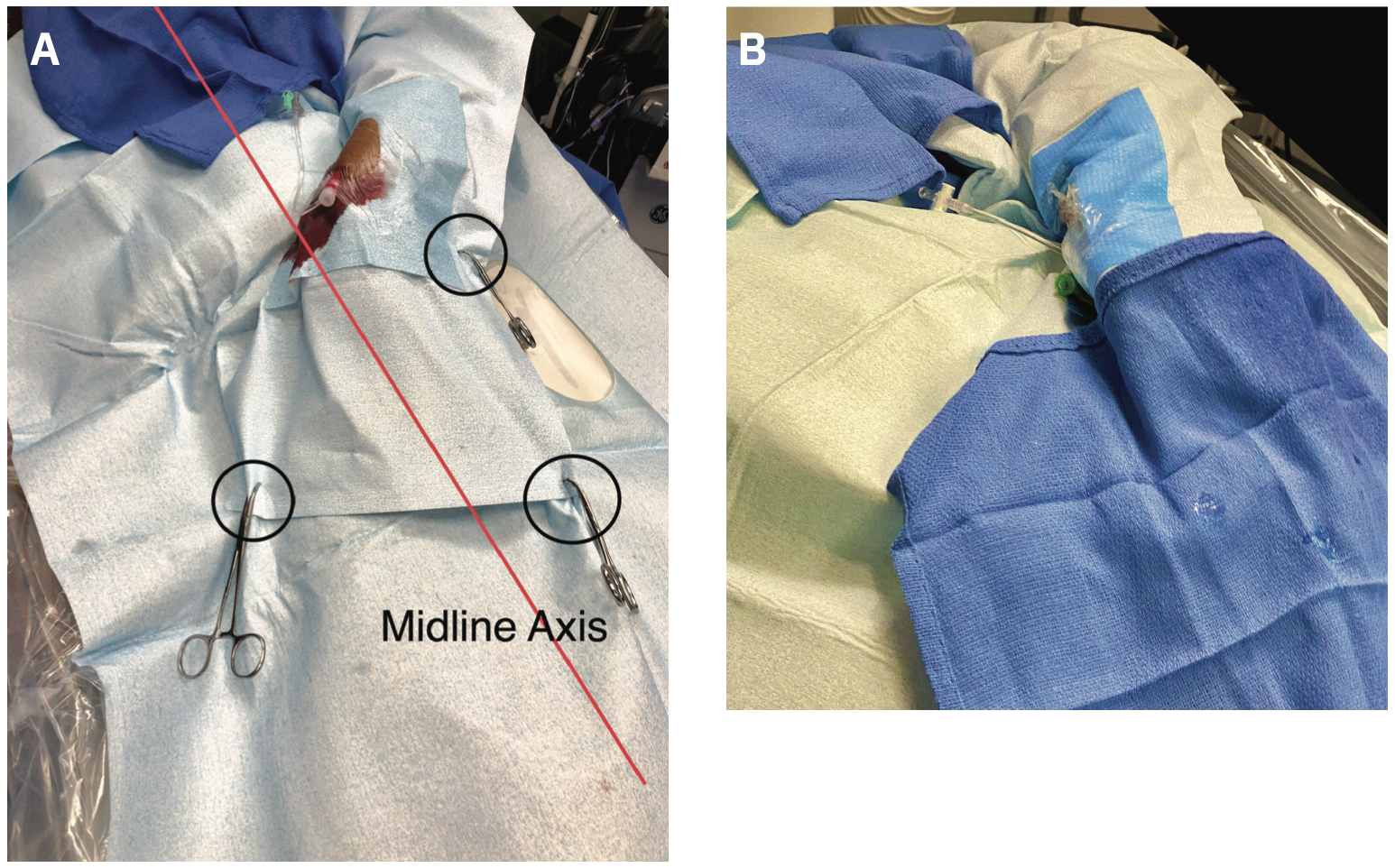 Casazza Left Ulnar Figure 3