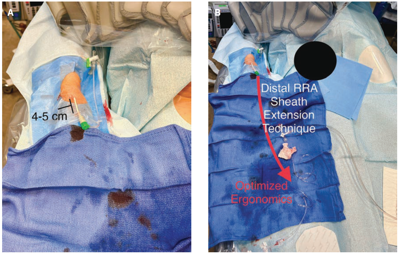 Casazza Radiation Exposure Figure 4
