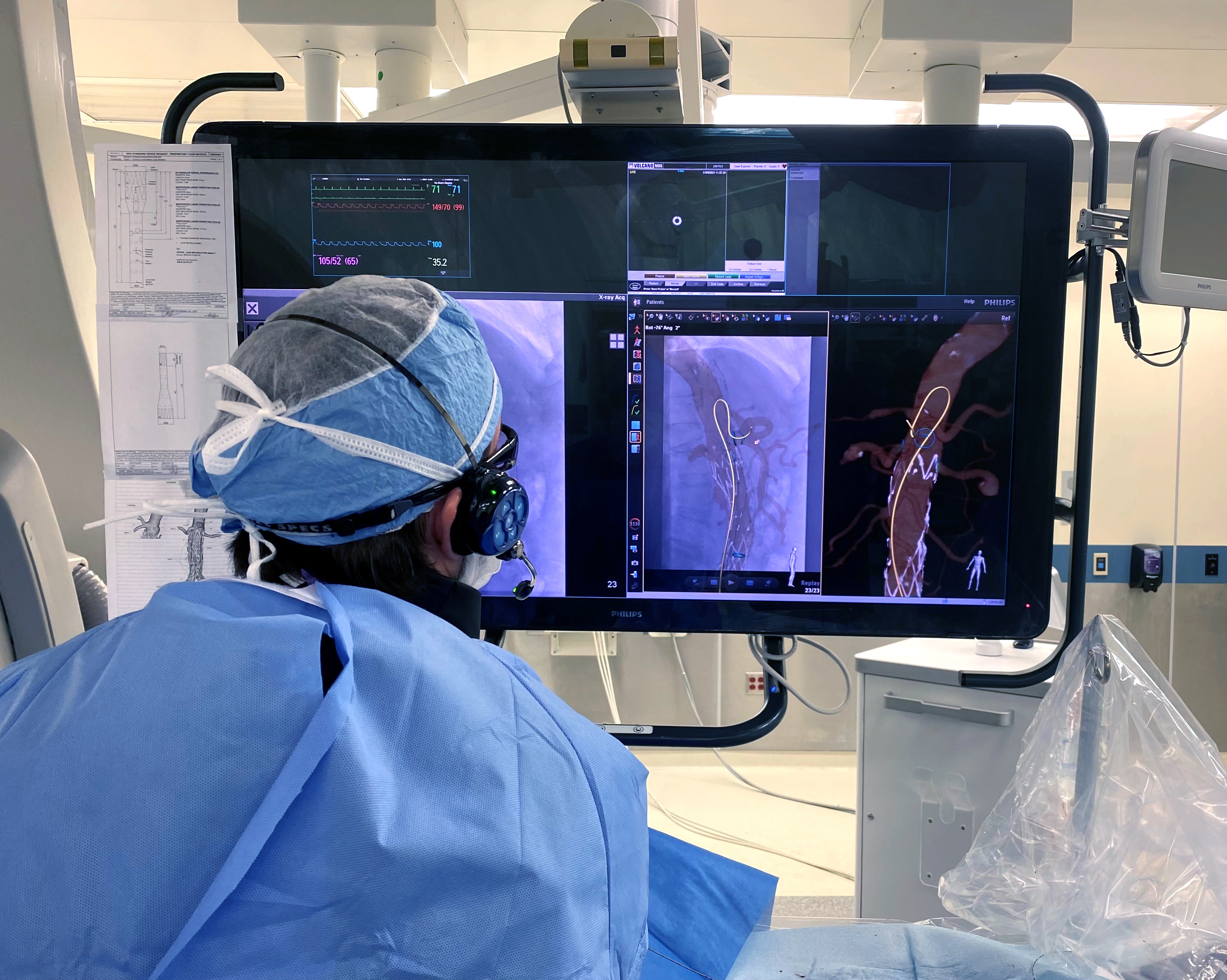 LumiGuide during a procedure