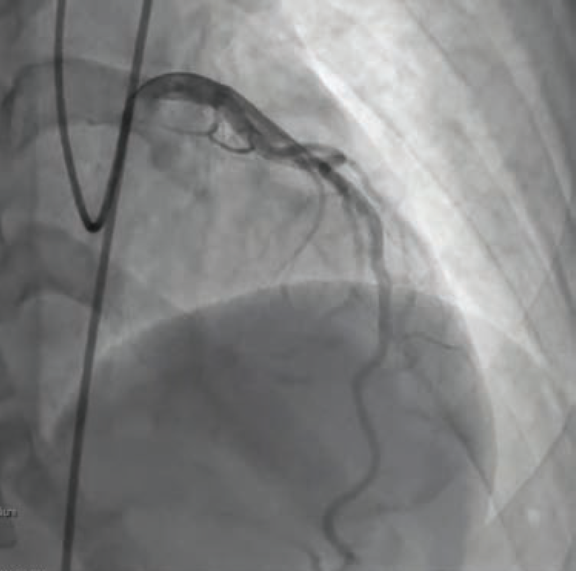 Case1-Fig1-May 2025_0.png 