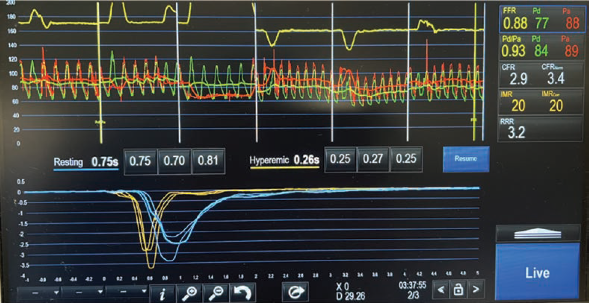Case1-Fig2-May 2025_0.png 