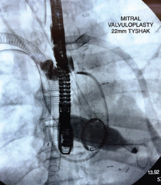 Case2-Fig-May 2025.png 