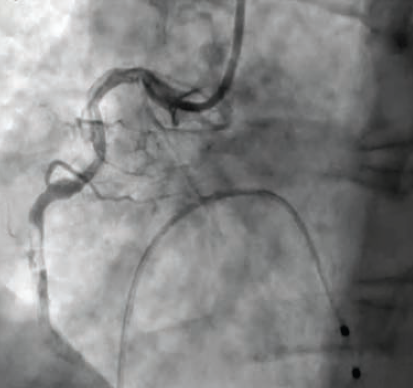 Case3-Fig1-May 2025.png