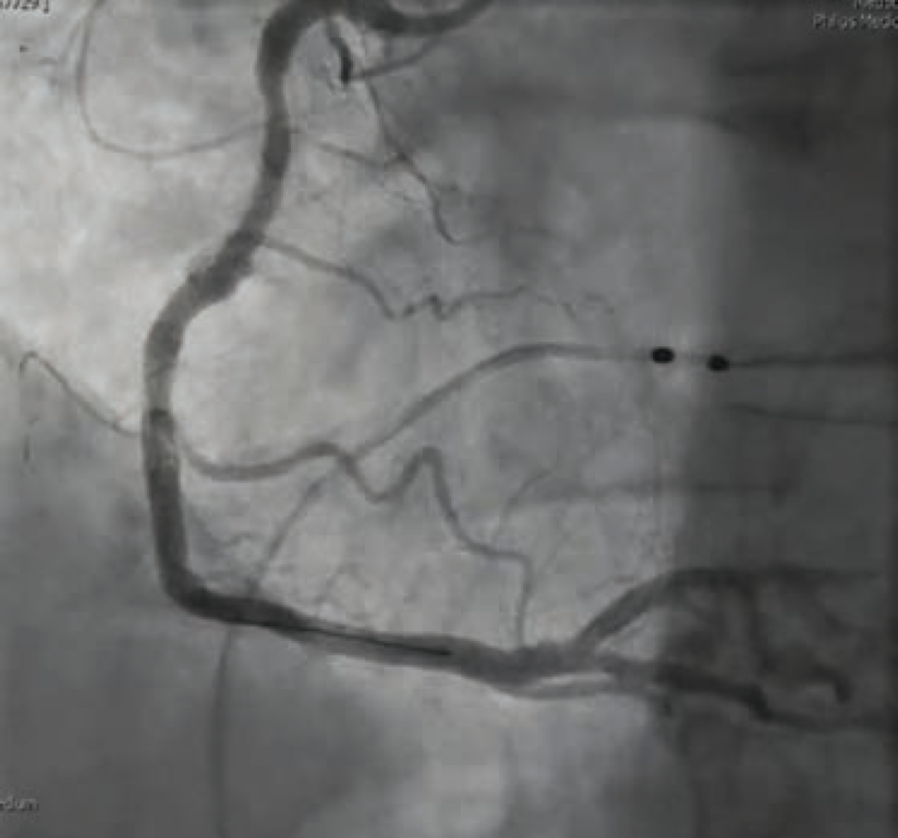 Case3-Fig2-May 2025.png 