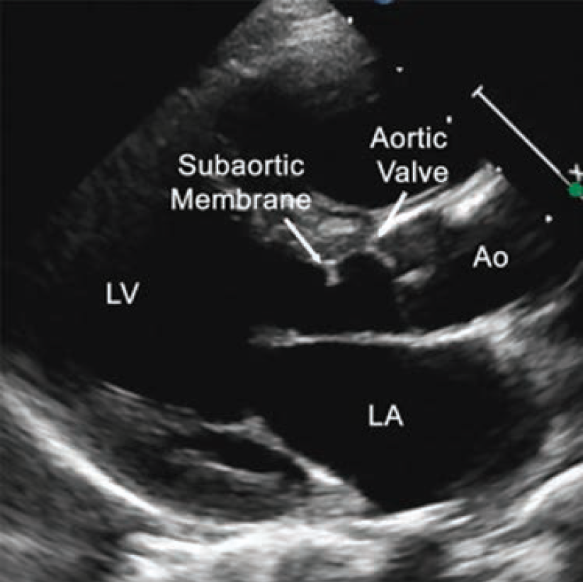 Case4-Fig1-May 2025.png 