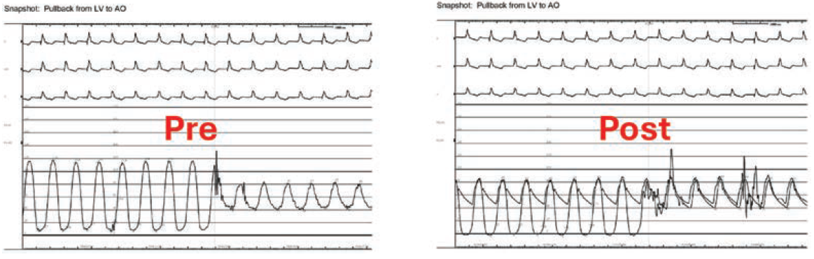 Case4-Fig2-May 2025.png 