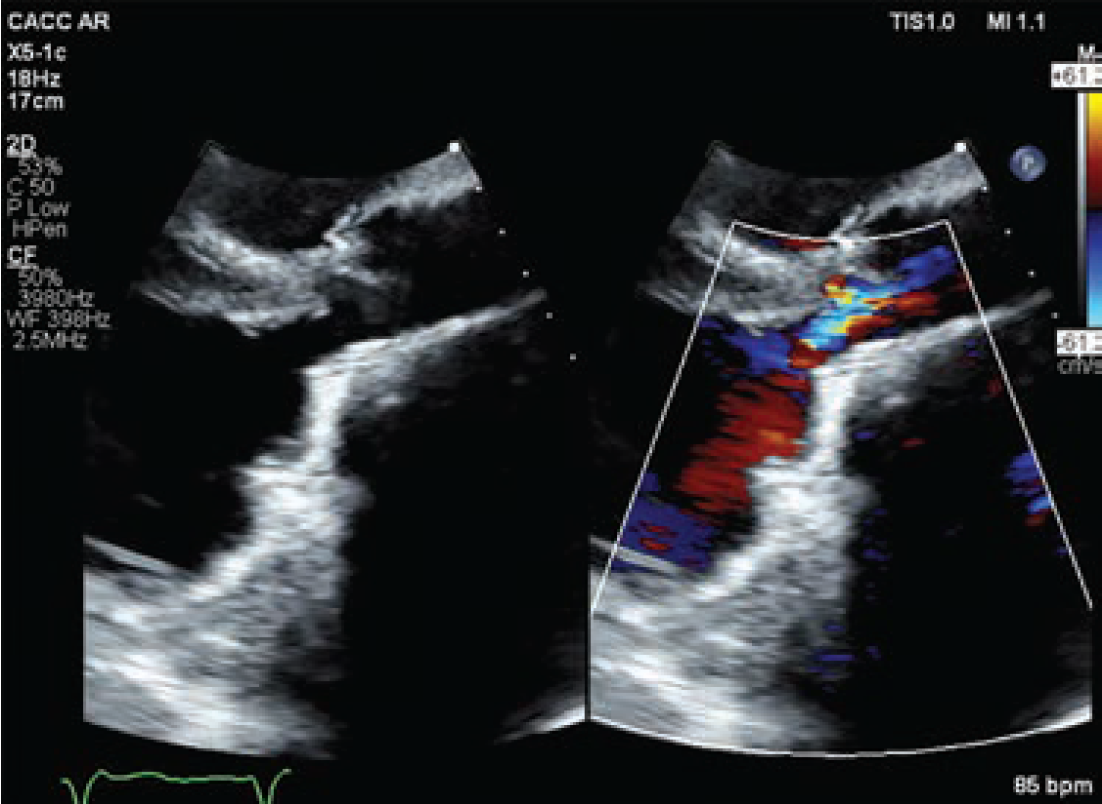 Case4-Fig3-May 2025.png 