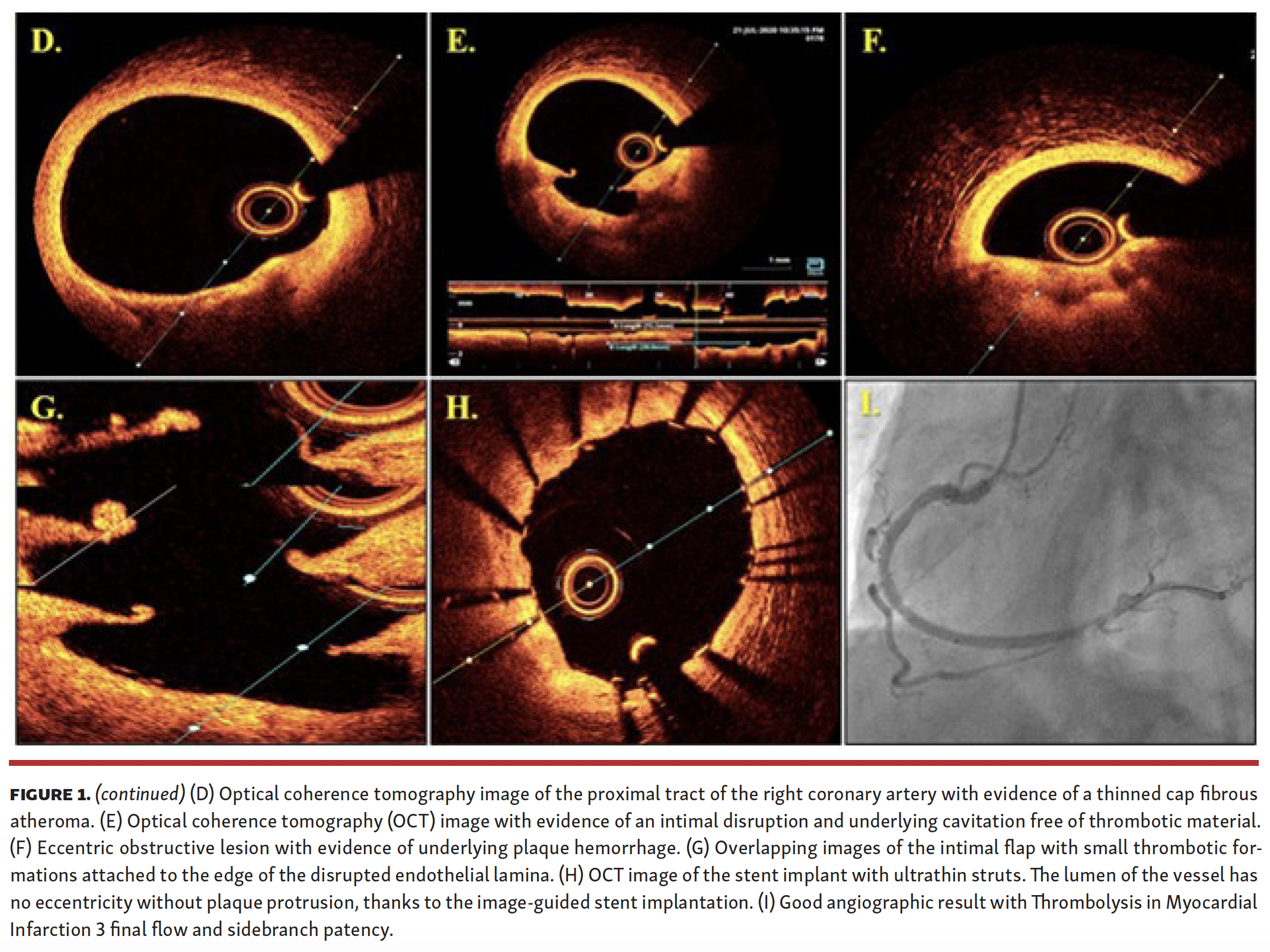 Cereda Figure 1 Part 1