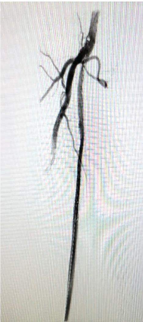 Chadda - Fig 2 - CLD Sept 2024