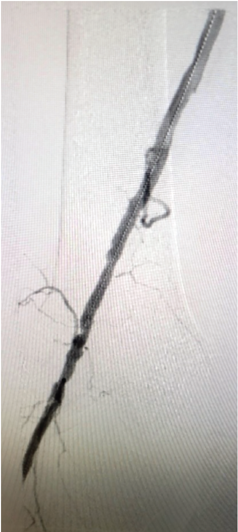 Chadda - Fig 3 - CLD Sept 2024