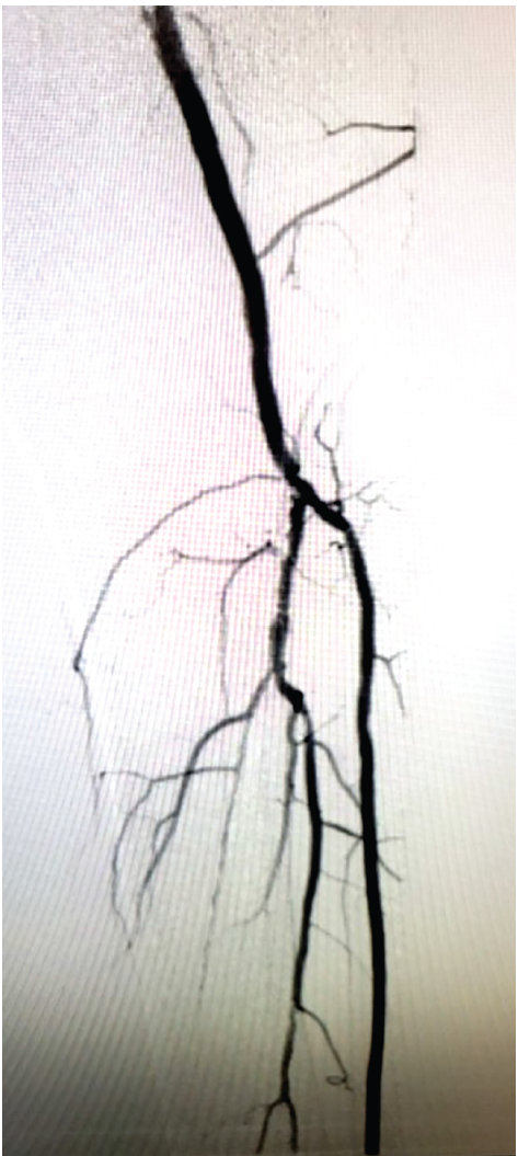 Chadda - Fig 4 - CLD Sept 2024