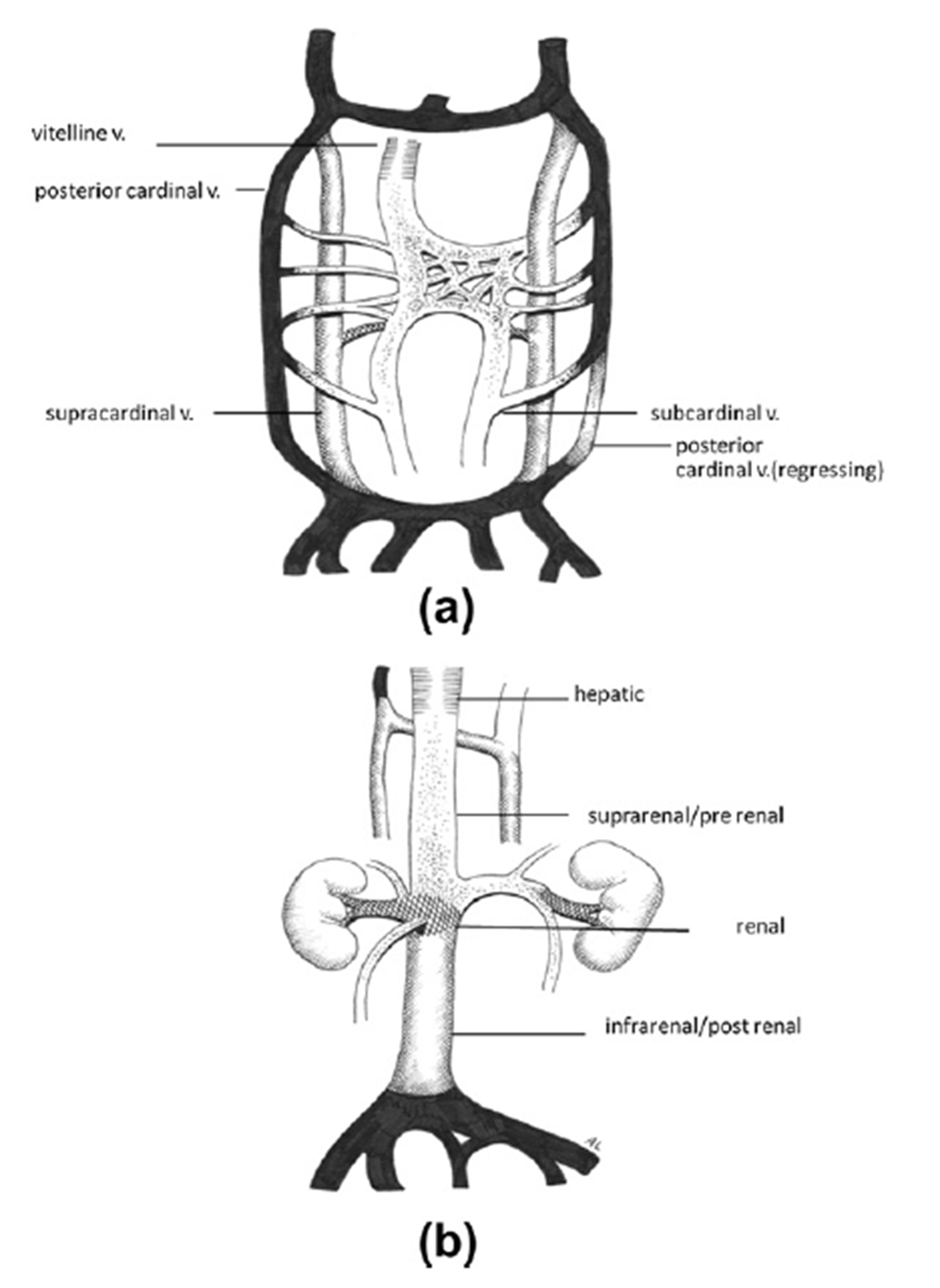 Figure 4. The embryonic venous system below the diaphragm