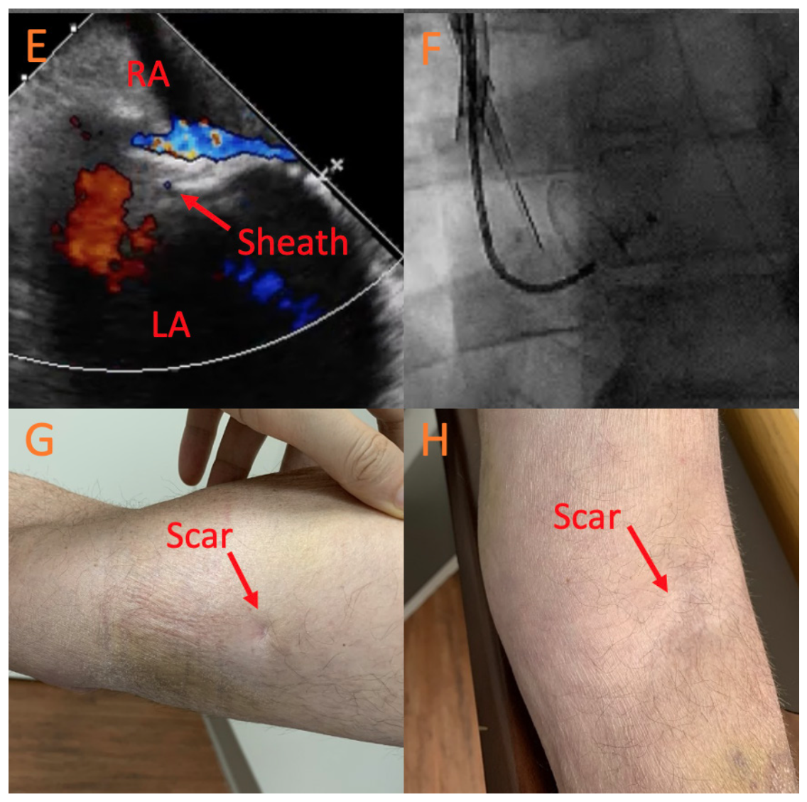 Chiang Deep Vein Thrombosis Figure 1B