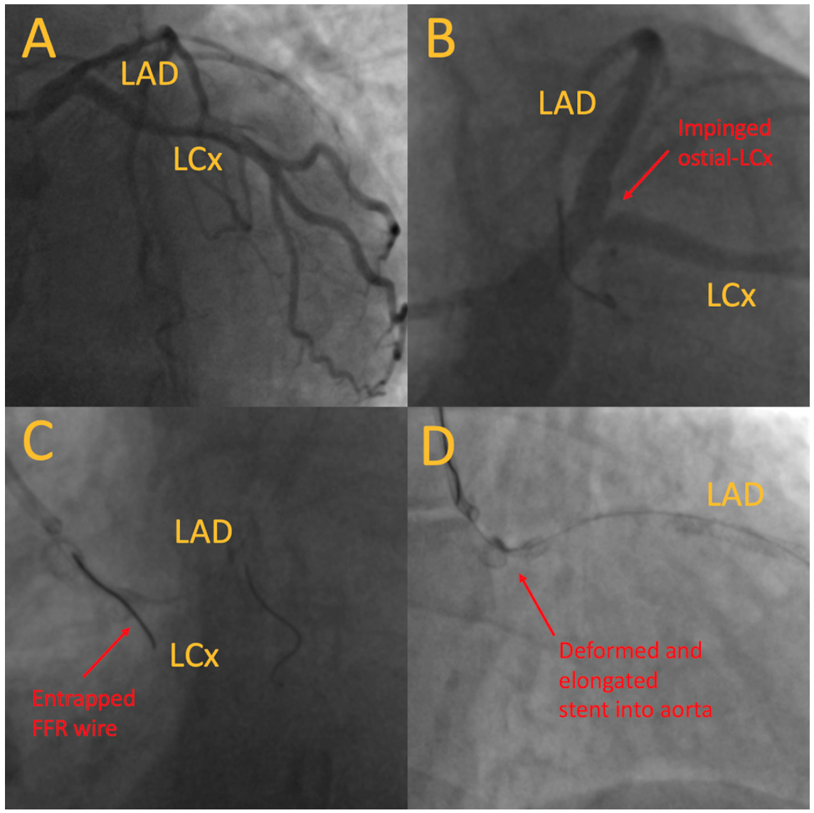 Chiang Snaring Figure 1