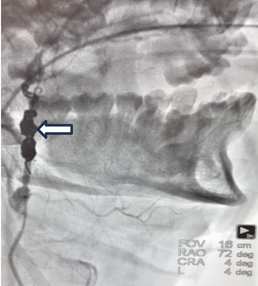 Cilingiroglu Figure 3