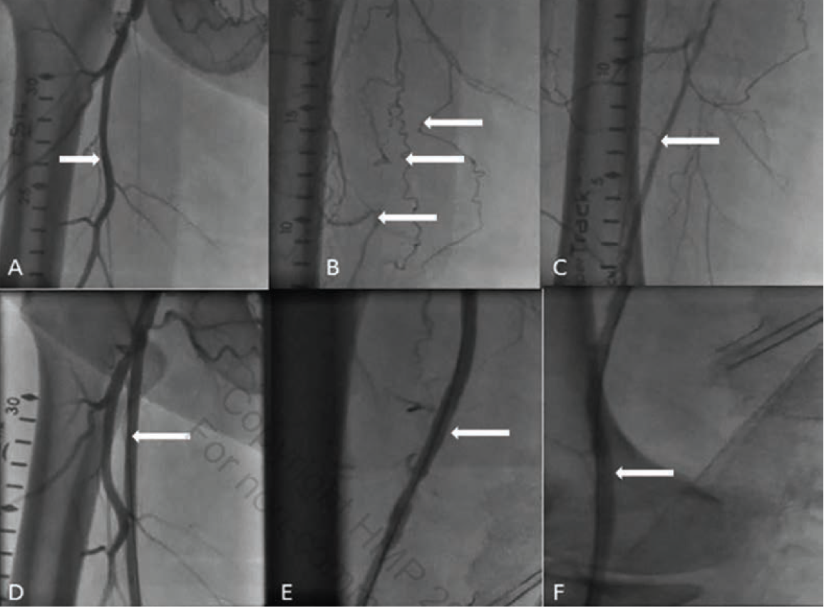 Cilingiroglu-Fig1-CLD-APRIL 2025.png 