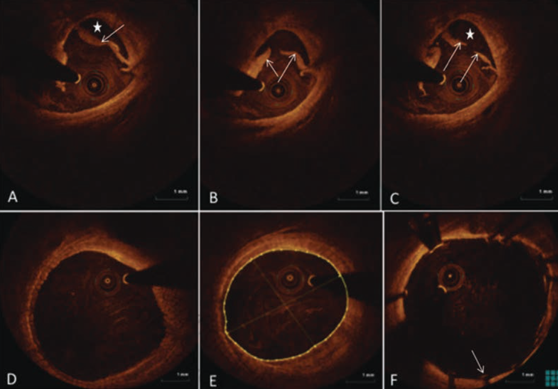 Cilingiroglu-Fig2-CLD-APRIL 2025.png