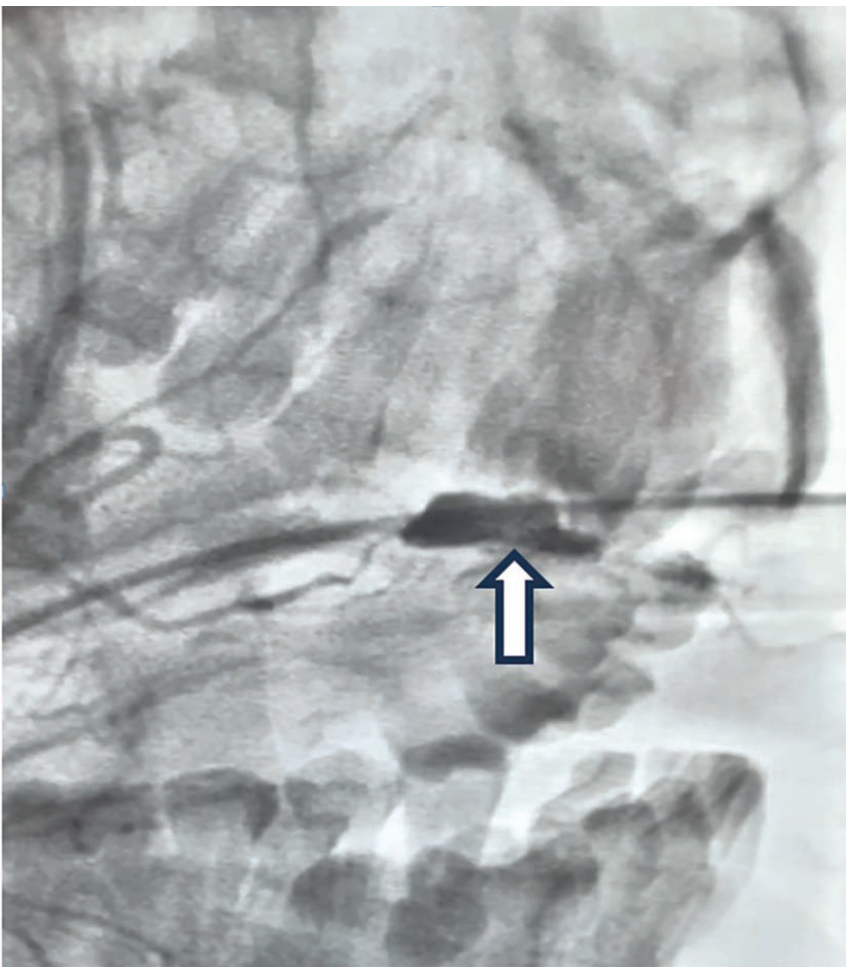 Cilingiroglu-Fig2-Dec 2025.png 