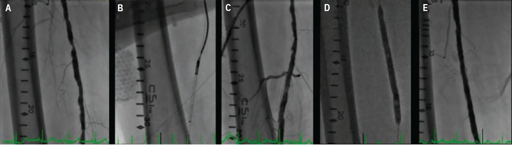 Cilingiroglu-Fig3-CLD-APRIL 2025.png 