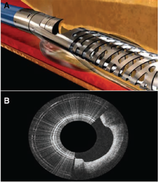 Cilingiroglu-Fig5-CLD-APRIL 2025.png 