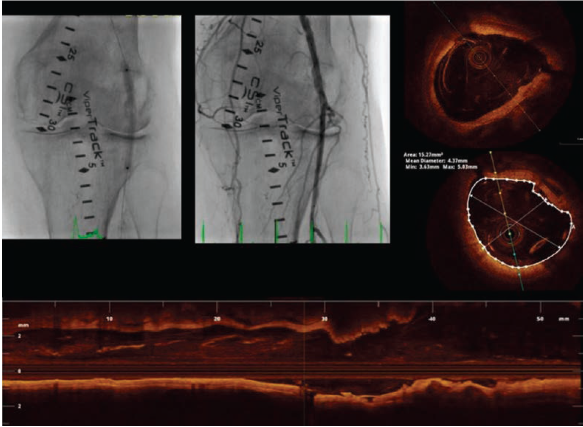Cilingiroglu-Fig8-CLD-APRIL 2025.png 