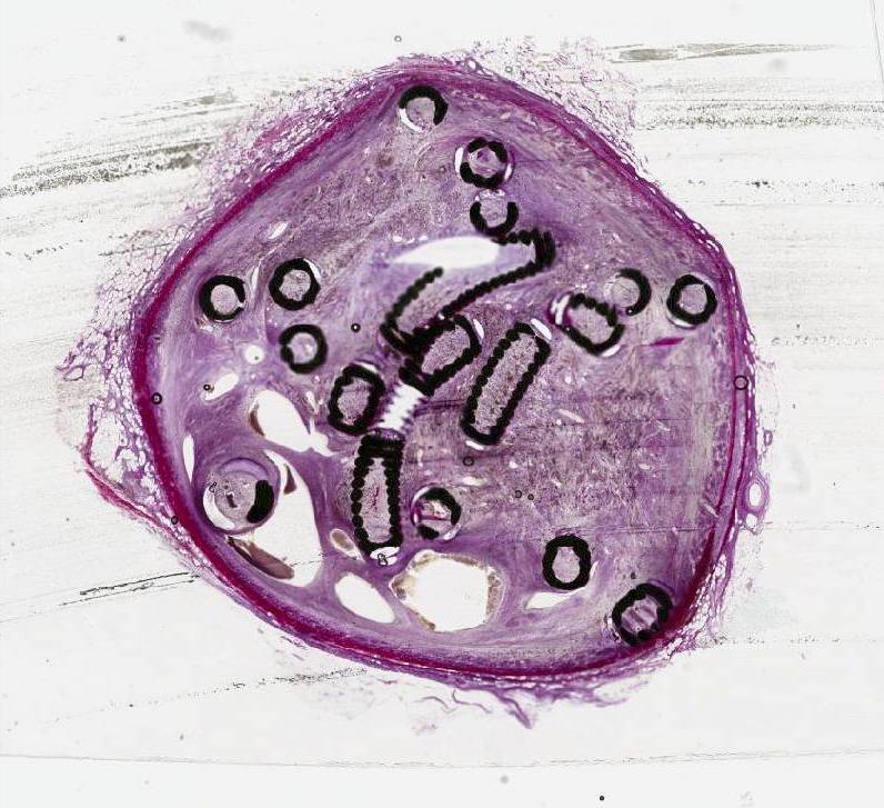 Coil study histologic tissue in resin