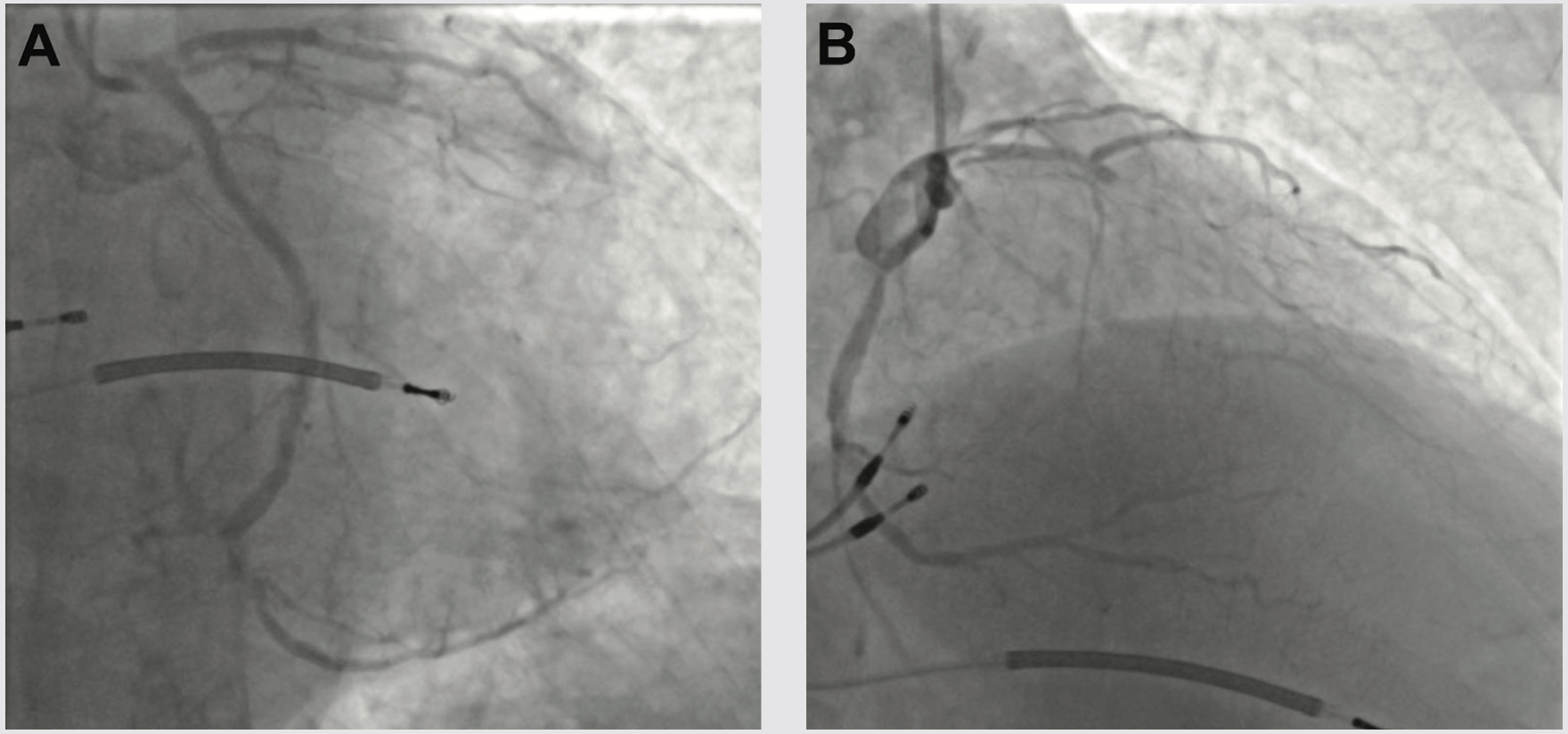 Croce Shockwave Figure 1