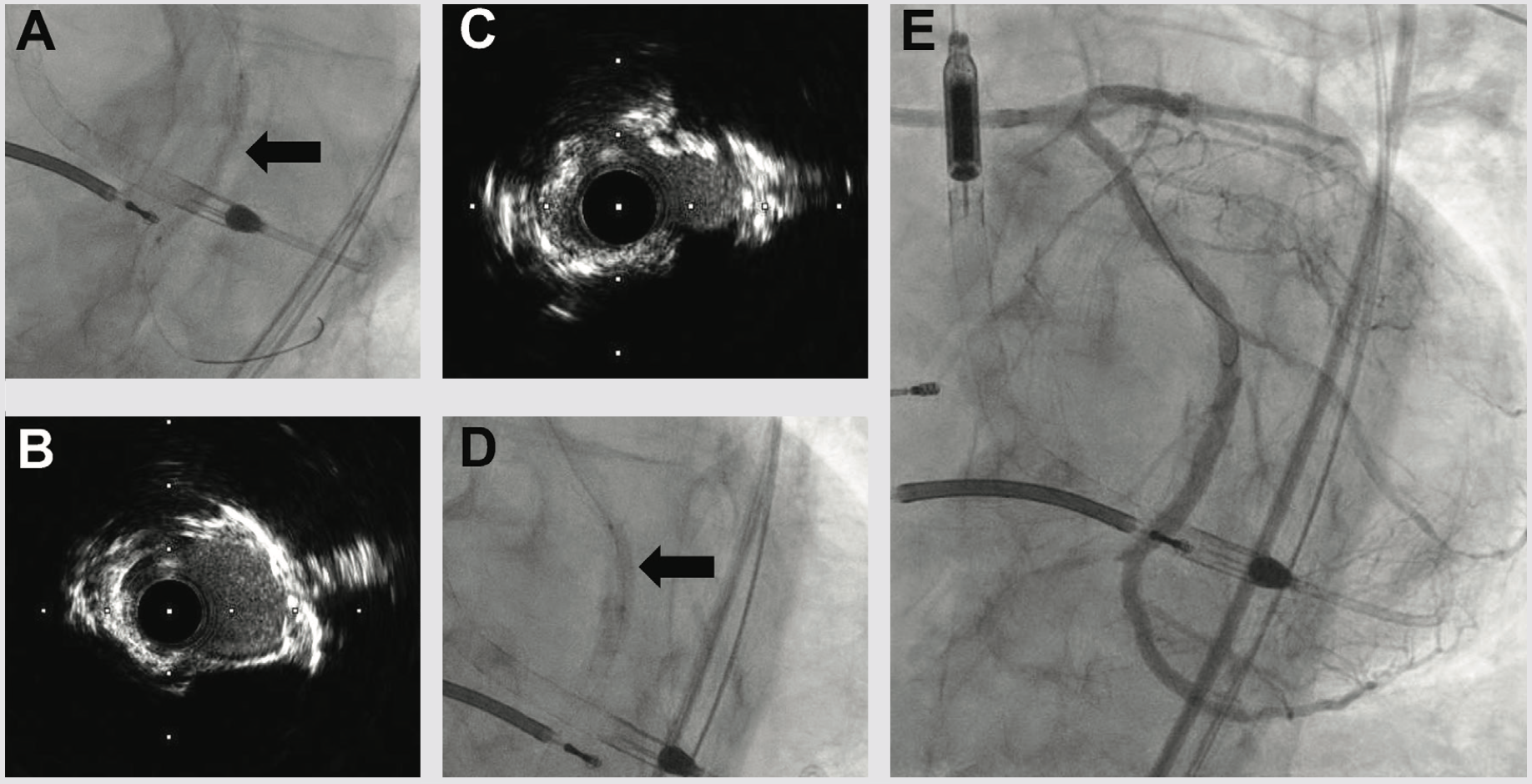 Croce Shockwave Figure 3