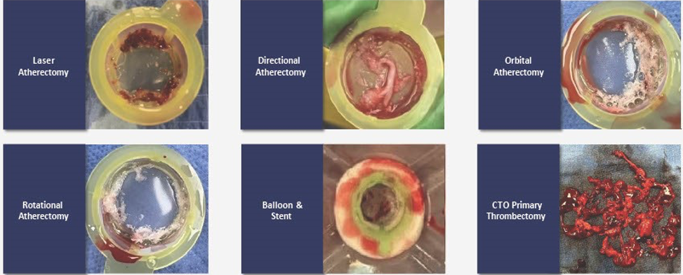 Figure 1. Representative images from 6 cases.&nbsp;