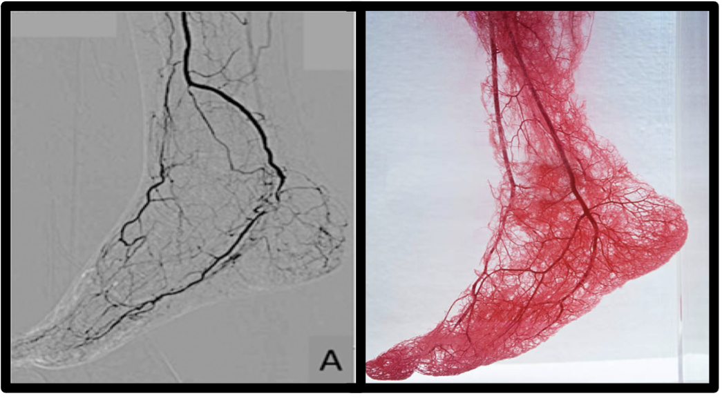 Figure 1. Angiography visualizes named vessels, not the distal microcirculation.