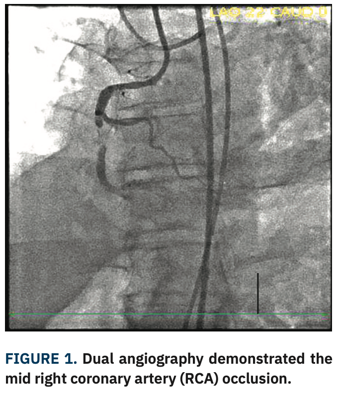 DeMartini ARTIS case Figure 1