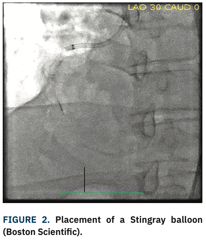 DeMartini ARTIS case Figure 2