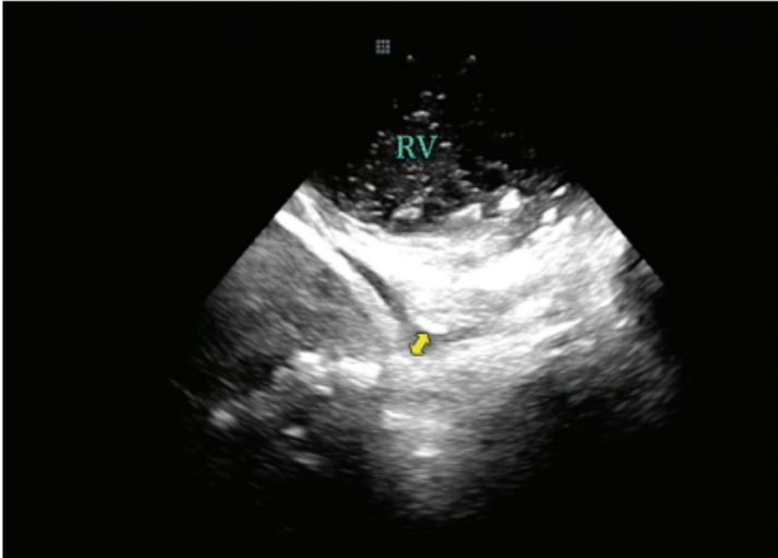 Demo - Fig 2 - Nov 2024 