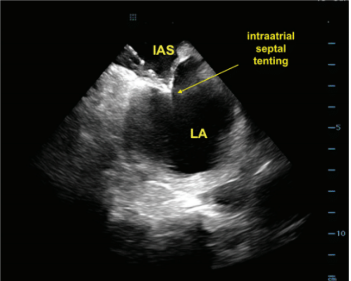 Demo - Fig 4 - Nov 2024 