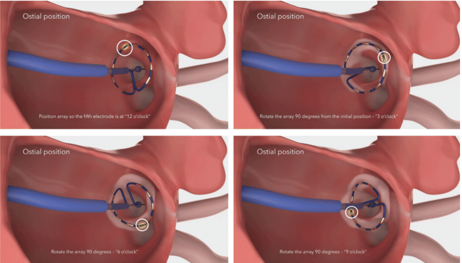 Demo - Fig 9b - Nov 2024 