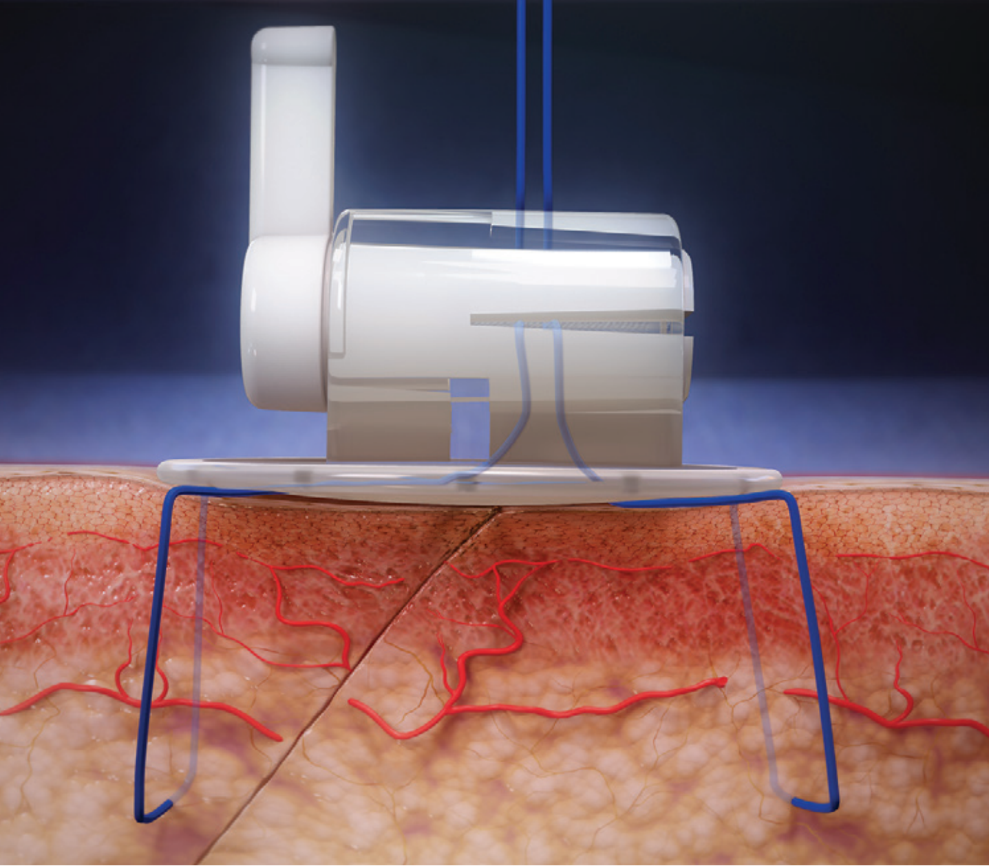 Di Biase-Fig2-Oct 2025.png 