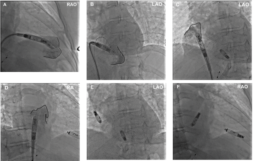 Diamantakos - Fig 1 - EPLD - Sept 2024