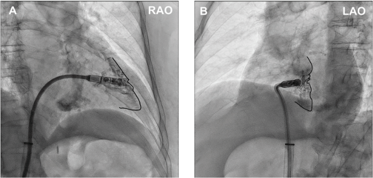Diamantakos - Fig 2 - EPLD - Sept 2024