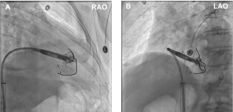 Diamantakos - Fig 3 - EPLD - Sept 2024