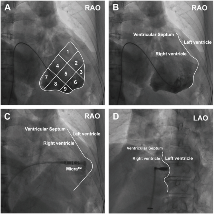 Diamantakos - Fig 4 - EPLD - Sept 2024