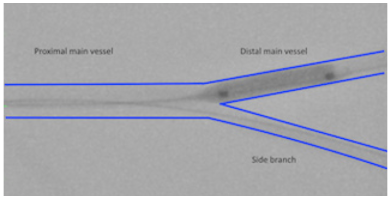 Ding Bifurcation Figure 2