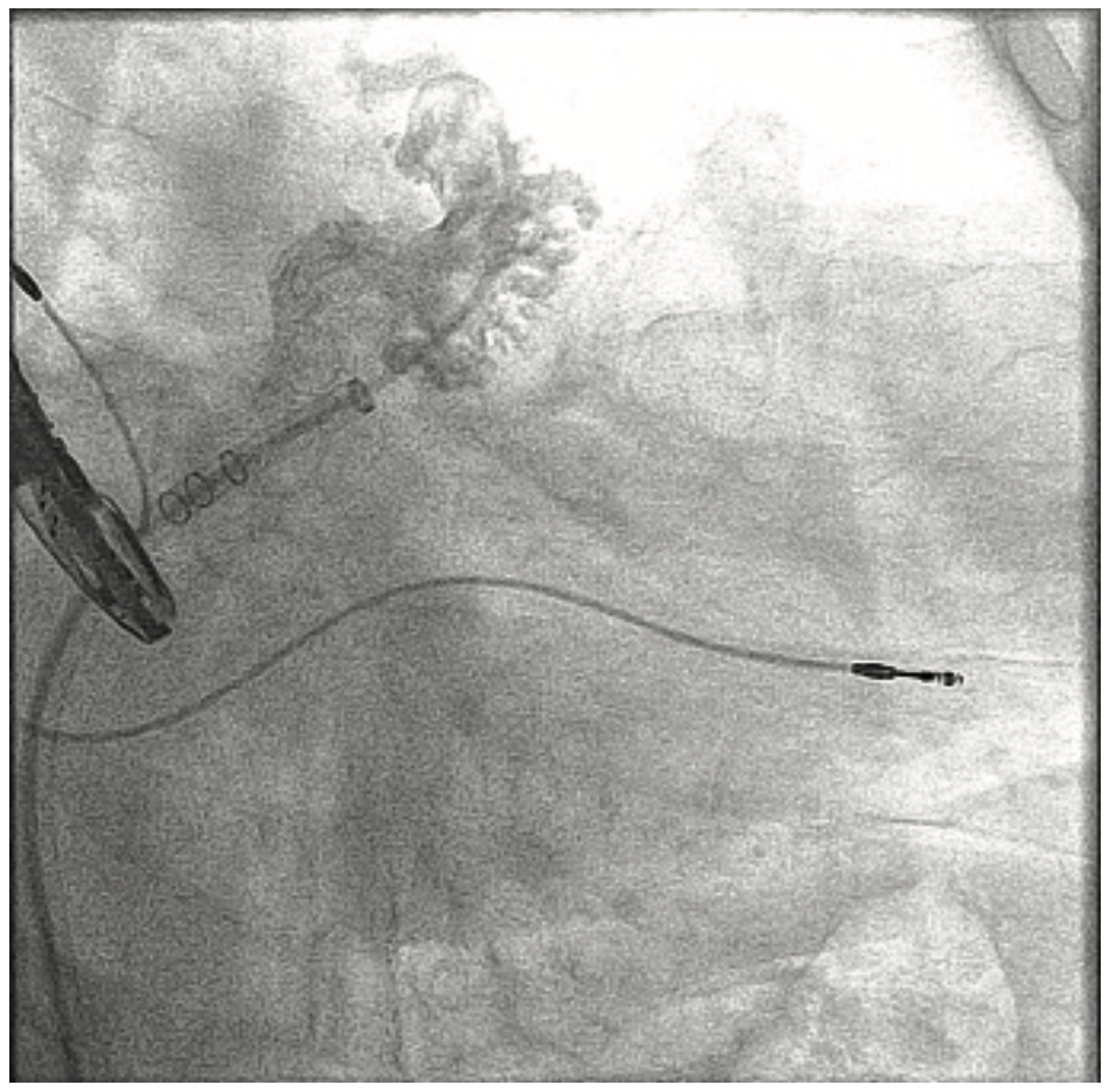 Don ACIST CVi System Image 1