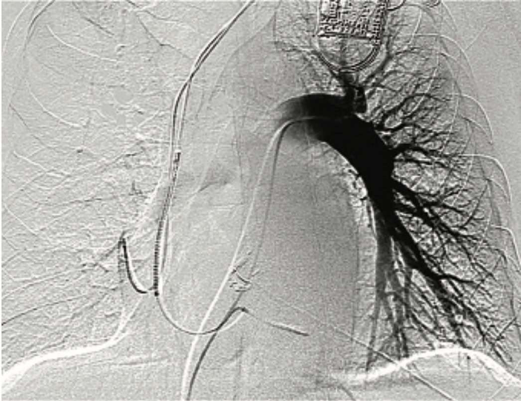 Don ACIST CVi System Image 3