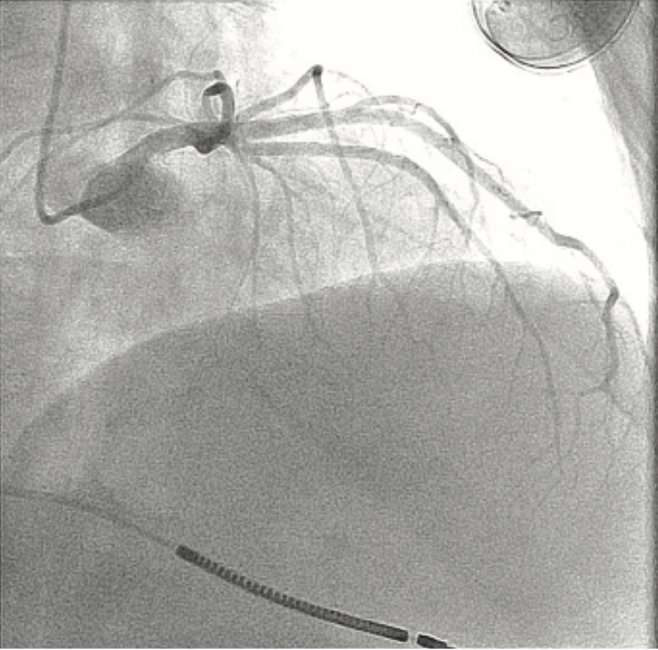 Don ACIST CVi System Image 4