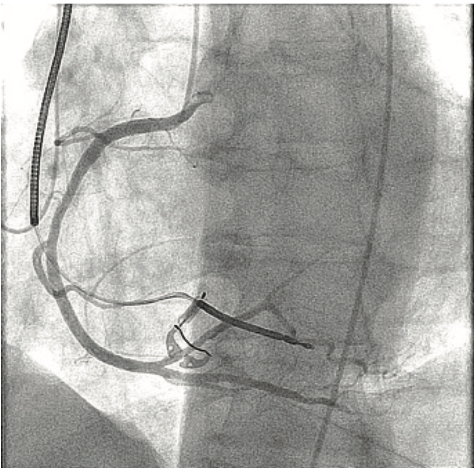 Don ACIST CVi System Image 5
