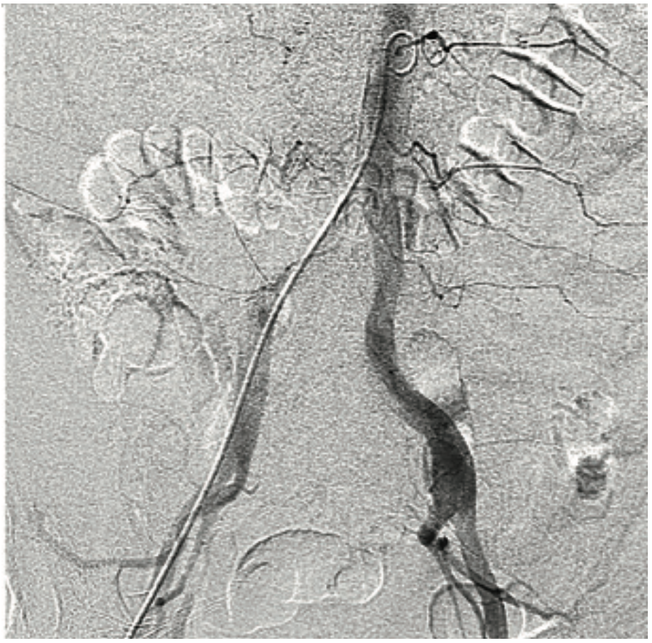Don ACIST CVi System Image 6