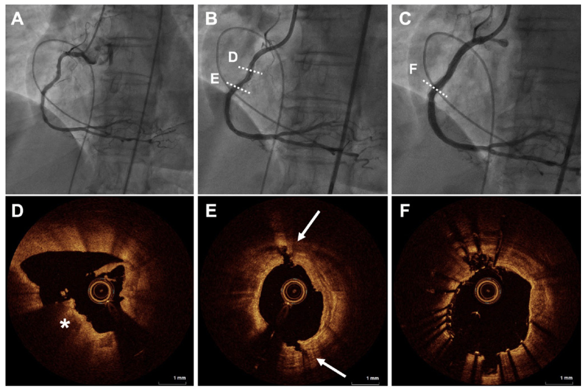 Dwivedi RotaTripsy Strategy Figure 1